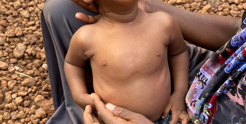 Ibrahima Diogo, très malade, a besoin d'une opération urgente