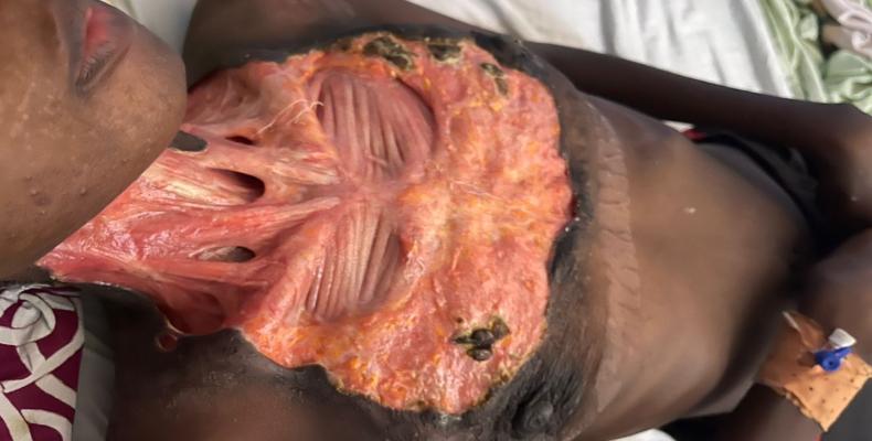 Sauvons Bountouraby avant qu'il ne soit trop tard